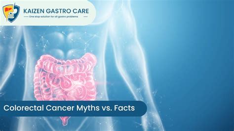 Colorectal Cancer Myths Vs Facts Kaizen Gastro Care