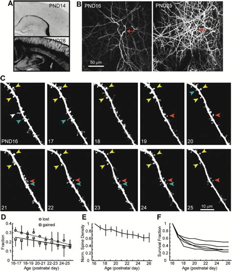 Transient And Persistent Dendritic Spines In The Neocortex In Vivo Neuron