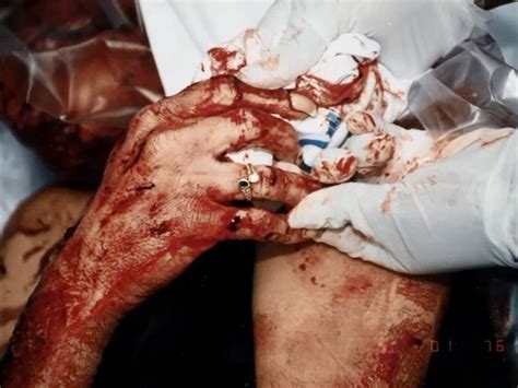Nicole Brown Simpson And Ronald Goldman Crime Scene Photos