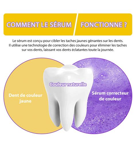 Dentifrice Violet De Blanchiment Kontrol Ml Sourire Clatant