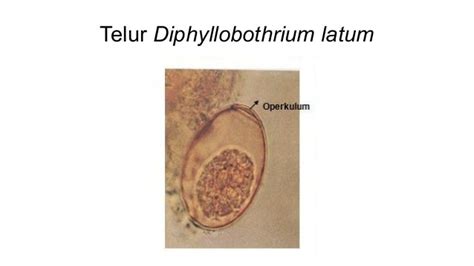 D Caninum D Latum Sparganosis Schistosoma