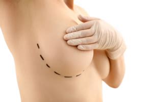 Best Plastic Surgeon In Brazil For Cosmetic Surgery Rosique Plastic