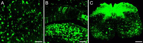 Intravenous Injections in Neonatal Mice