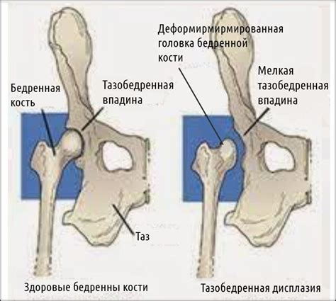Кривошея у грудника: диагностика и лечение заболевания