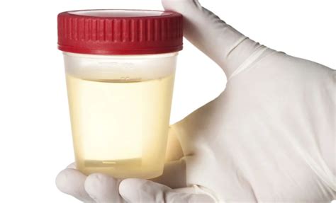 О чем говорит цвет и запах вашей мочи — Не для галочки, а для друзей