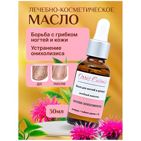 Средство от грибка ногтей и онихолизиса с маслом чайного дерева ...