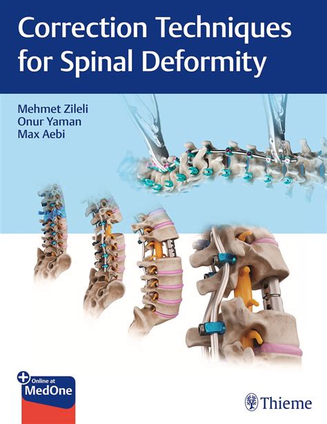 Correction Techniques For Spinal Deformity 9789395390101 Thieme Webshop