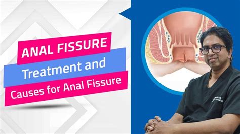 Oreol Medtech What Is Anal Fissure Causes Treatment Of Anal Fissure Youtube