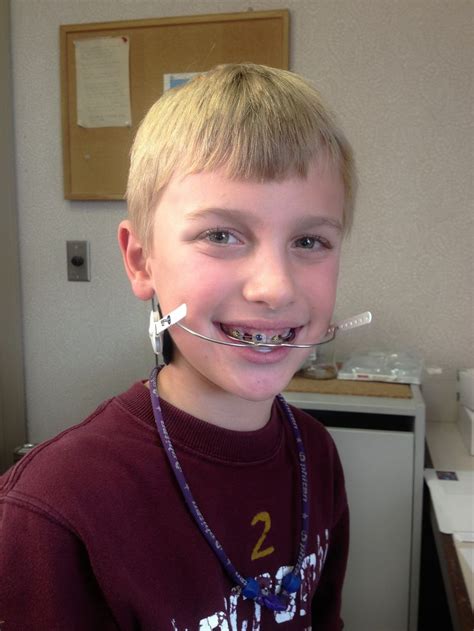 Pin By Carsten Nitschke On Zahnspange Blonde Hair Boy Blonde Hair Blonde