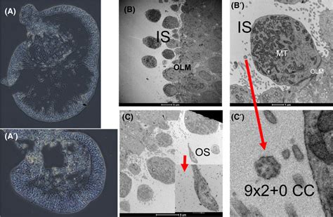 Light Microscopy And Transmission Electron Microscopy Structural