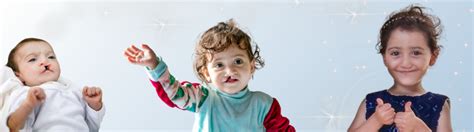 gift operation smile canada operation smile canada