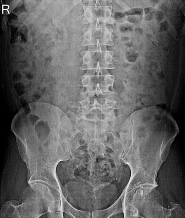 Radiology Quiz 87571 Radiopaedia Org