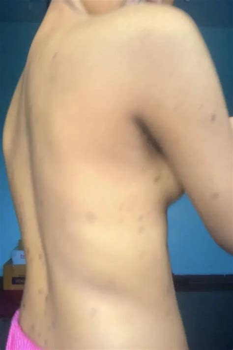 Fuck 4 Nude Pics XHamster