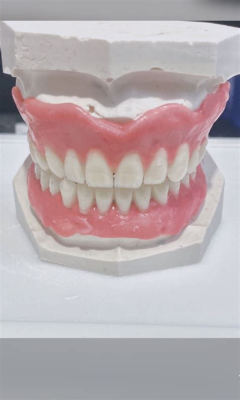 Do It Yourself Denture Kit Acrylic Resin False Teeth At Home Etsy