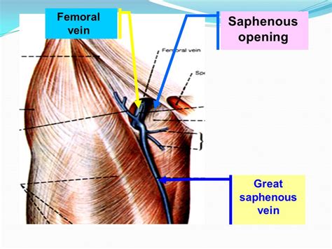 Saphenous opening