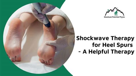 Shockwave Therapy For Heel Spurs A Helpful Therapy