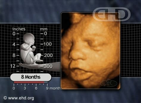 Secular Pro-Life Perspectives: Baby Chris is 32 Weeks Old