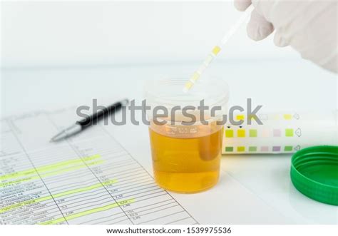 Check Routine Urinalysis Reagent Strip Urinalysis Stock Photo