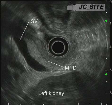 Standard Imaging Methods In The Pancreatobiliary Region Using Radial