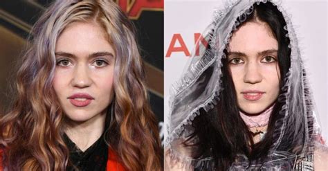 Grimes Posts Selfie for First Time After Surgery and Fans Seem Concerned