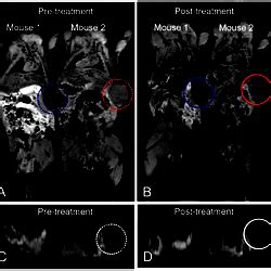 T2 Weighted MR Images Of Nude Mice With Breast Tumor Obtained A Before And B After Injection
