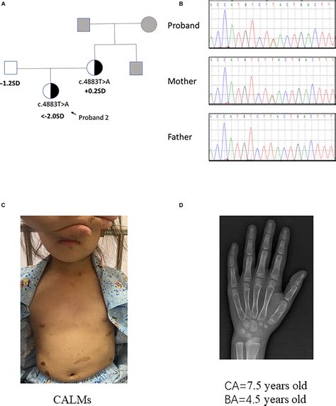 Frontiers | Characterization of Two Loss-of-Function NF1 Variants in ...