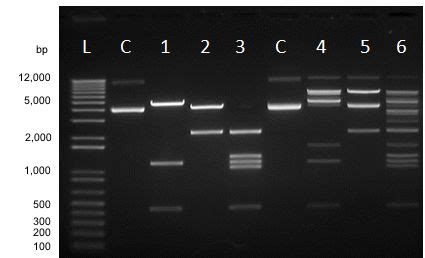 The Invitrogen Anza Restriction Enzyme Cloning System Is A Complete