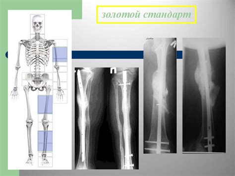 Травматология. Этапы медицинской помощи. Вопросы теории лечения ...
