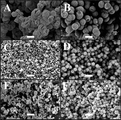 Exemplary scanning electron microscopy (SEM) microphotographs of the ...