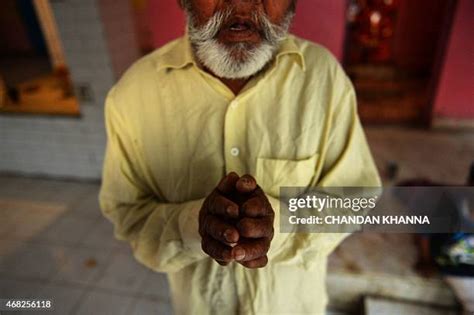 images  leprosy stock  high res pictures  images