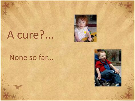 Jacobsen syndrome | PPTX