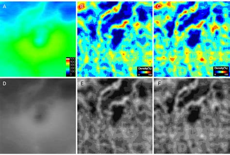 Conversion Of Color Coded Retinal Thickness And Vessel Density Map Of