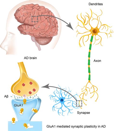 GluA1 mediated synaptic plasticity in AD. In AD brain, deficits in ...