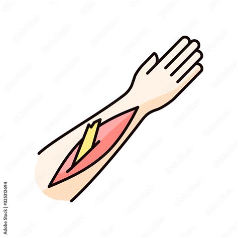 Open Bone Fracture Rgb Color Icon Bone Sticking Out Of Human Arm