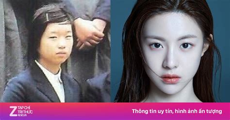 Nhan sắc lạ lẫm trước khi dao kéo của hot girl đình đám Hàn Quốc Giới trẻ ZNEWS VN