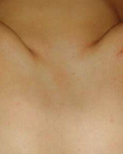 Spanked Porn Pics XXX Photos Sex Images App Page PICTOA