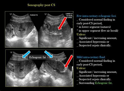 Ultrasonography Vs Ultrasound