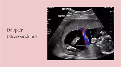 Types Of Ultrasound Scan Pdf