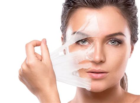 Peeling Químico Clínica Rasc Itanhomi