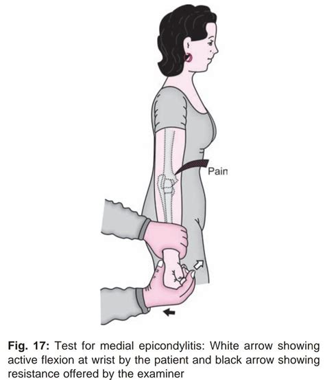 Test For Medial Epicondylitis Dr Sheenam Bansal