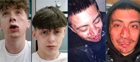 Roma coppia gay aggredita con calci e pugni da ragazzi perché camminava mano nella mano SPYit