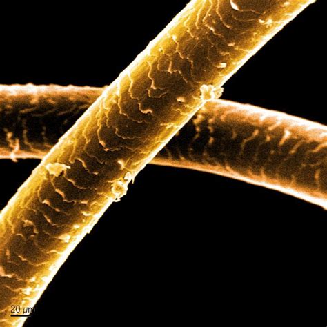 Sem Image Of Human Hair Nise Network