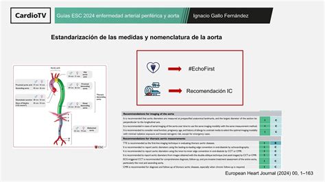 Guías ESC aorta y enfermedad arterial periférica II PPT