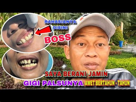 Sebab Akibatnya Gigi Palsu Tidak Awet Dengan Cara Ini Saya Berani