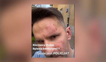 Bosak Pobity Przez Kierowc Z Aplikacji Policja Komentuje