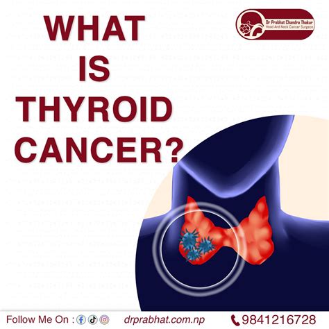 thyroid cancer dr prabhat chandra thakur