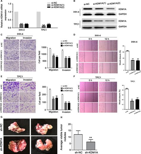 Kdm A Knockdown Inhibited Papillary Thyroid Cancer Ptc Cell Migration