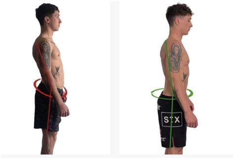 Swayback Secrets How To Fix Sway Back Posture Fm Physio