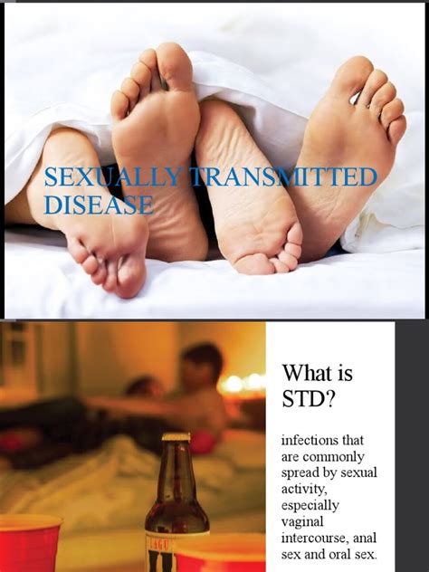 Sexually Transmitted Disease Pdf Management Of Hivaids Sexually