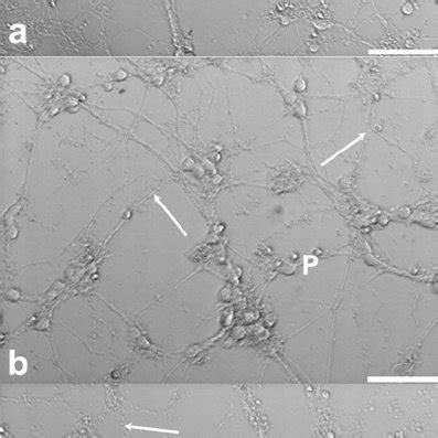 Morphological effects of 3-HAA-induced neurotoxicity Treatment for 1 h... | Download Scientific ...